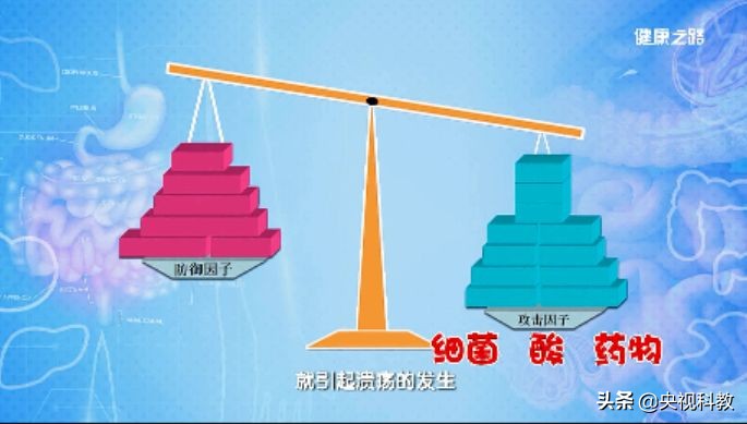 胃溃疡幽门螺杆菌中药治疗,胃溃疡加幽门螺杆菌的详细用药