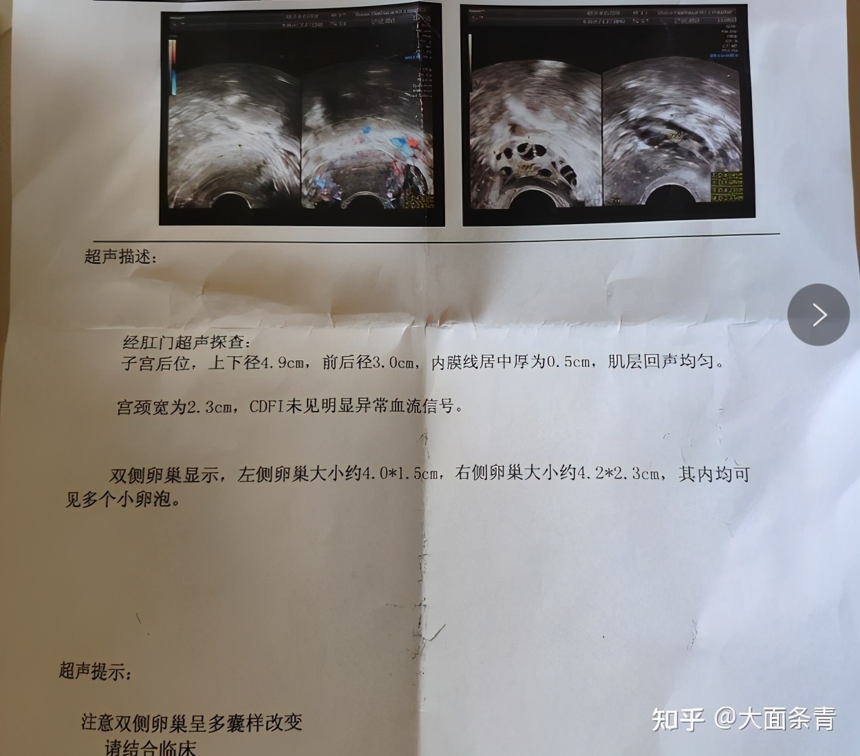 生病的心态一点都不好,生病的人心态很悲观怎么安慰