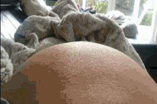 专家说:孕期羊水过多或过少,怎么办?