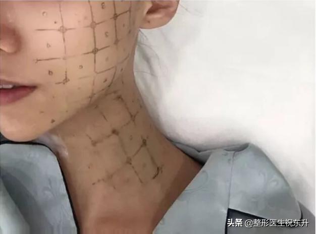 小女孩颈纹是怎么形成的,脖子上的颈纹是怎么形成的