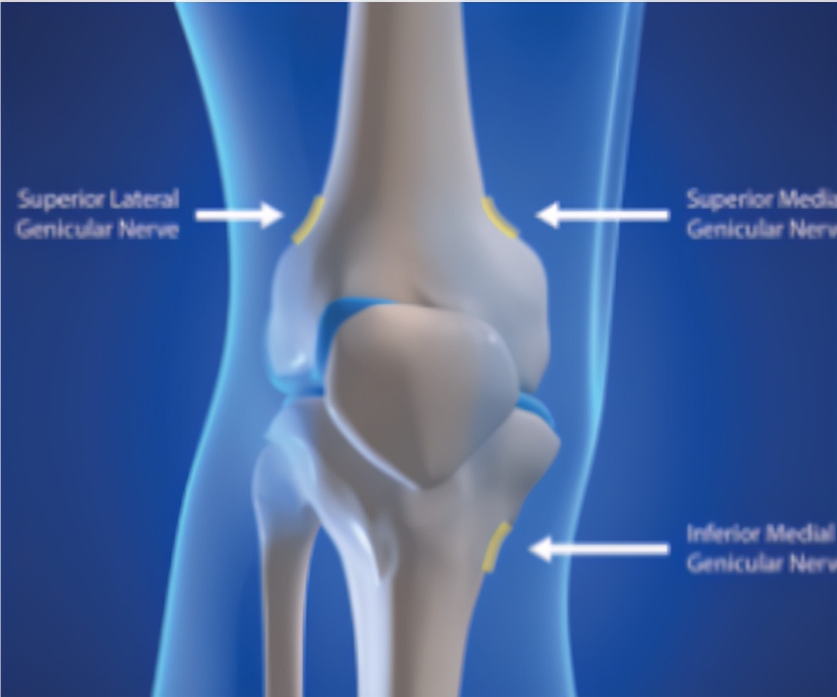 膝盖疼痛的原因和解决方法,腿膝盖老是疼痛是怎么回事
