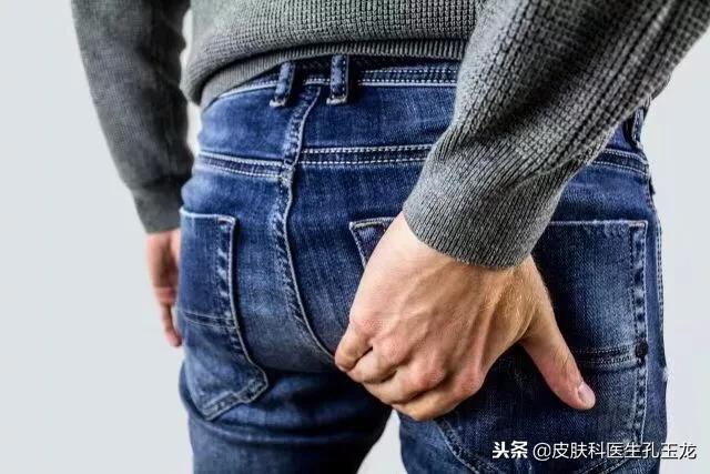 皮肤科医生股癣怎么治疗,皮肤科常见疾病