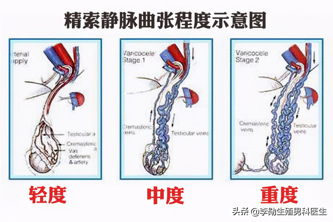 斩断三千烦恼丝英语,斩断三千烦恼丝方可破局