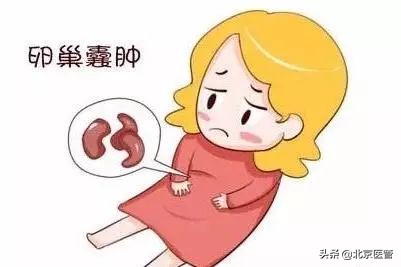 卵巢巧克力囊肿癌变的10个征兆,妇科检查时能查出卵巢囊肿吗