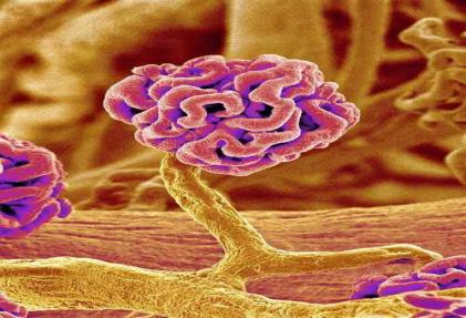 尿尿起沫肾不好吗,尿蛋白高尿尿起泡沫吗