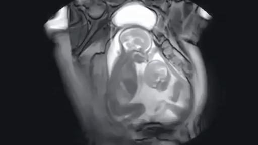 x射线下的人体图,x射线照片