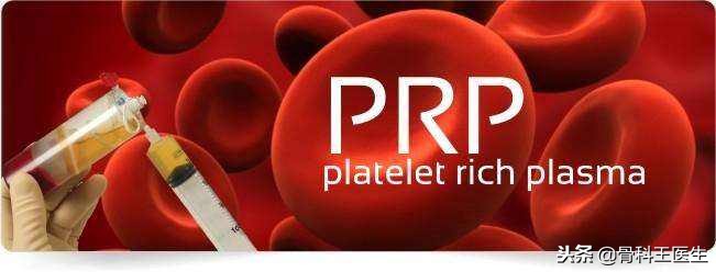 指南推荐！关节炎新疗法，PRP到底是何方神圣？