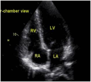 心脏彩超检查您了解吗,心脏彩超查的是胸吗