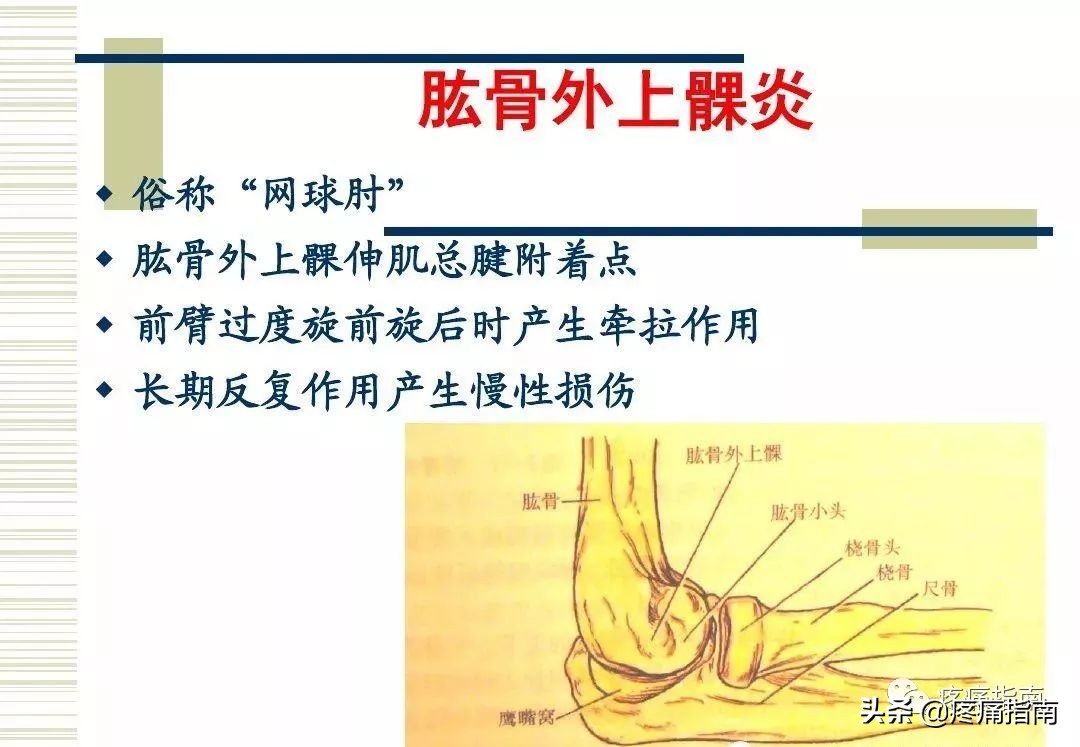 慢性疼痛常用的治疗方法,慢性疼痛常用治疗方法