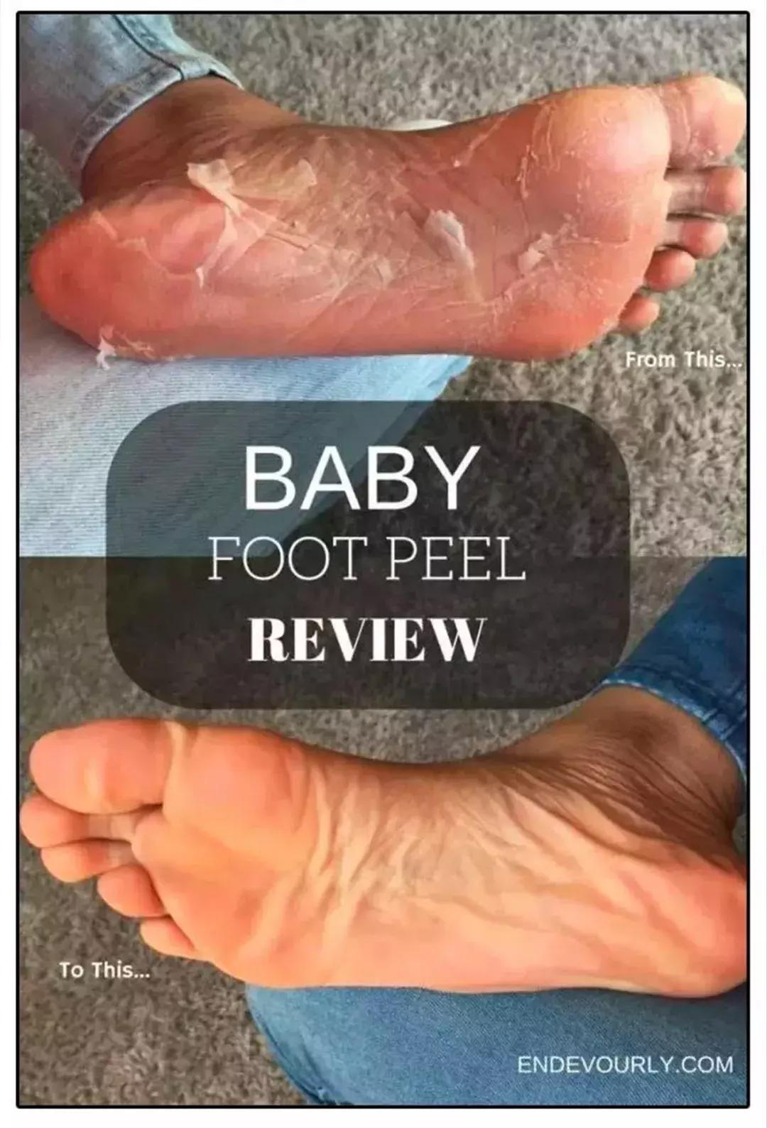 女大学生脚部异味难忍,在寝室羞于脱鞋!