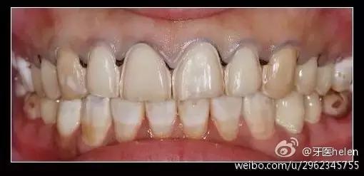 Helen齿科中心,helen牙齿