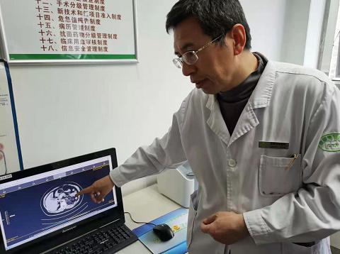 如何判断自己是不是满月脸水牛背,满月脸水牛背是什么原因引起的