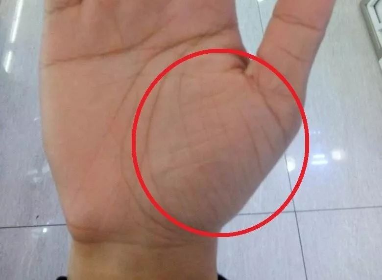 手诊10种常见病从手上就能看出来,手形看健康