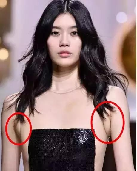 超模收副乳,超模消除副乳