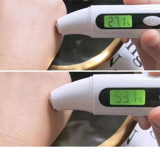 大s注射玻尿酸,大s爆料圈内美女