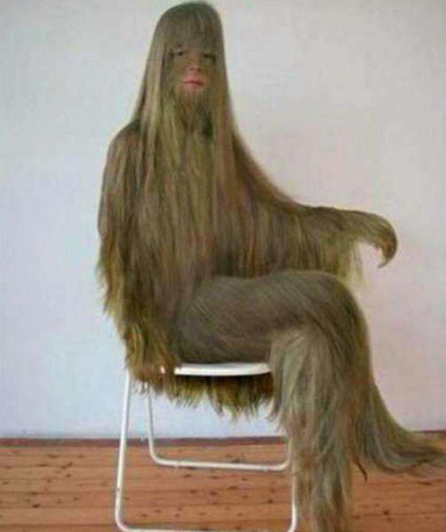 女子浑身长毛发,女子全身长毛发