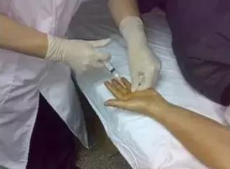 关节封闭针怎么打,关节疼打封闭针视频