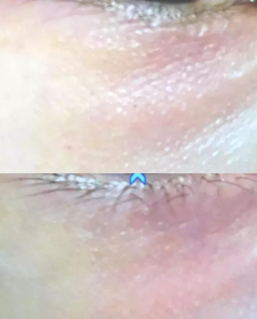 有了前法国第一夫人的百元“黑科技”眼霜，我把3000块眼霜扔了！