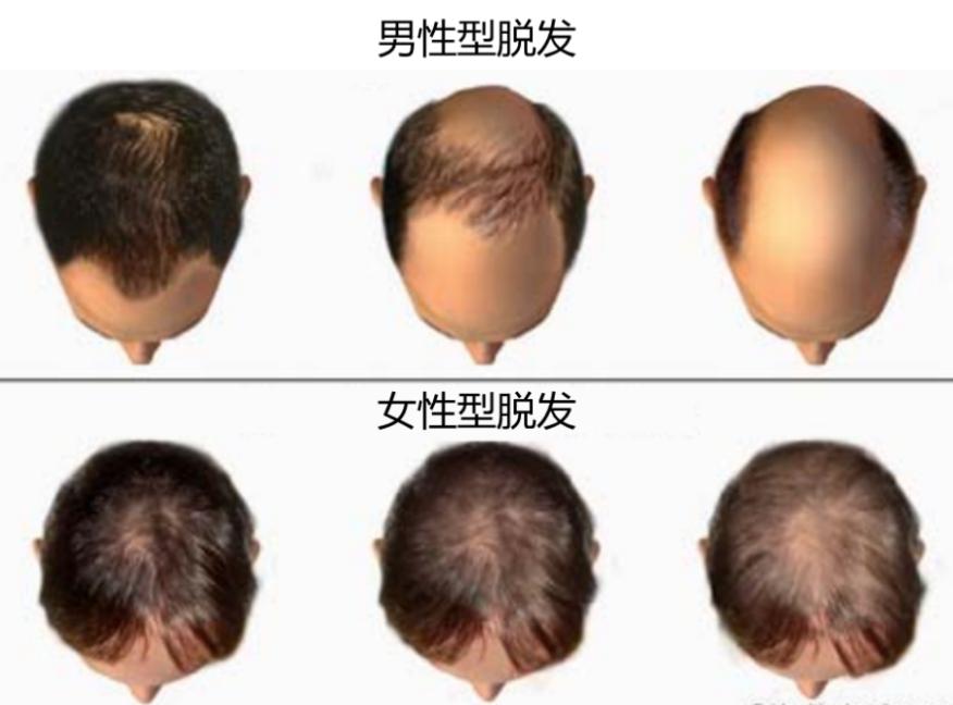 金斯瑞解析,金斯瑞基因治疗发展