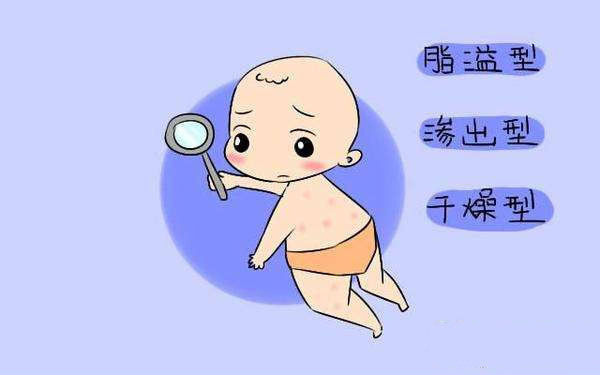 婴幼儿湿疹是什么原因造成的,婴幼儿湿疹是什么原因引起的