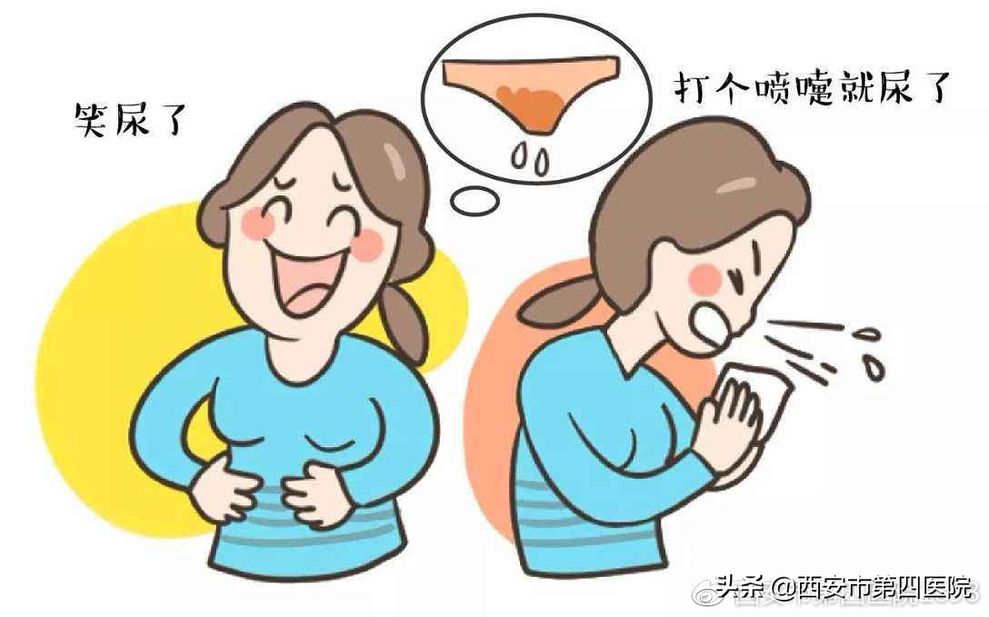 产后如何应对尿失禁,产后尿不尽训练方法