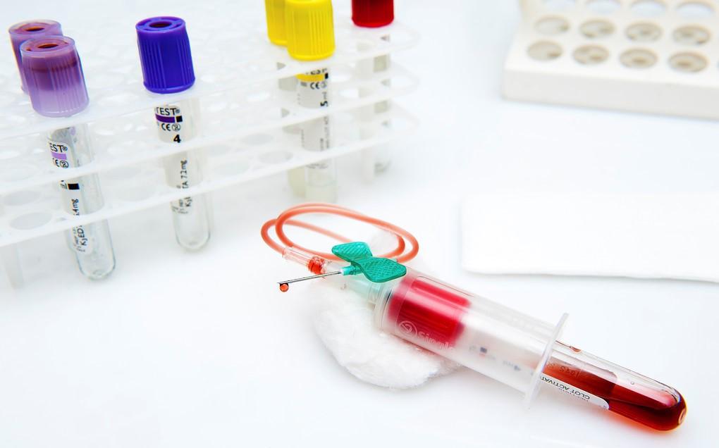 血脂高要怎样控制,怎么才能有效的控制血脂高