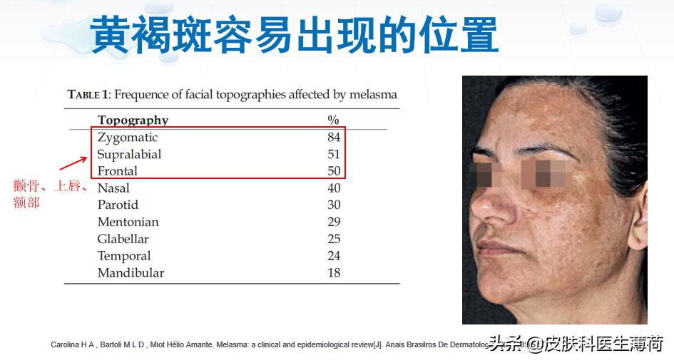 黄脸婆吃什么祛斑,告别黄脸婆自制纯中药祛斑面膜