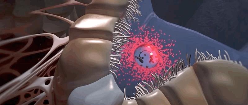 哮喘的发病原理,哮喘科普文章作品简介