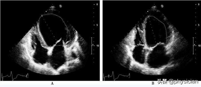冠心病造影不严重的话怎么治疗,冠心病造影难受吗
