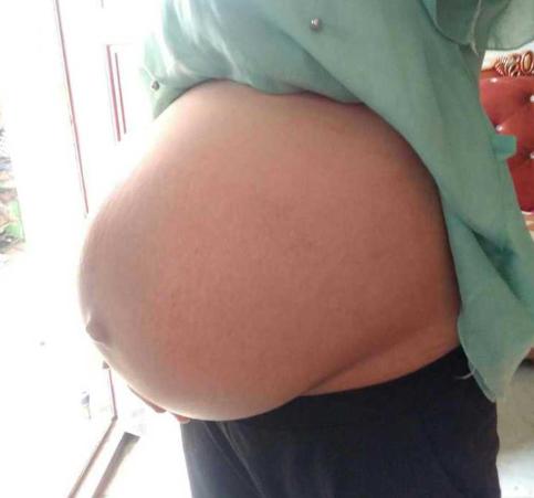 怀孕期间一直有炎症会影响胎儿吗,孕期一直有炎症对宝宝有影响吗