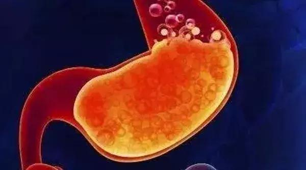 反酸烧心嗓子有异物感吃什么药,喉咙烧心反酸是咋回事