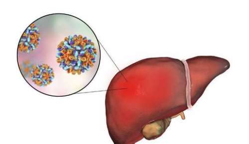 沈阳六院放疗,沈阳六院肿瘤介入治疗