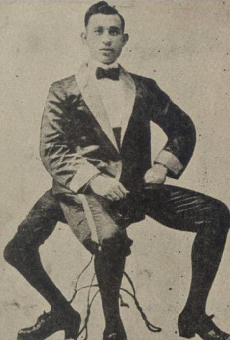 他是美国马戏圈里的“国王”，拥有三条腿，结过两次婚，活了77岁