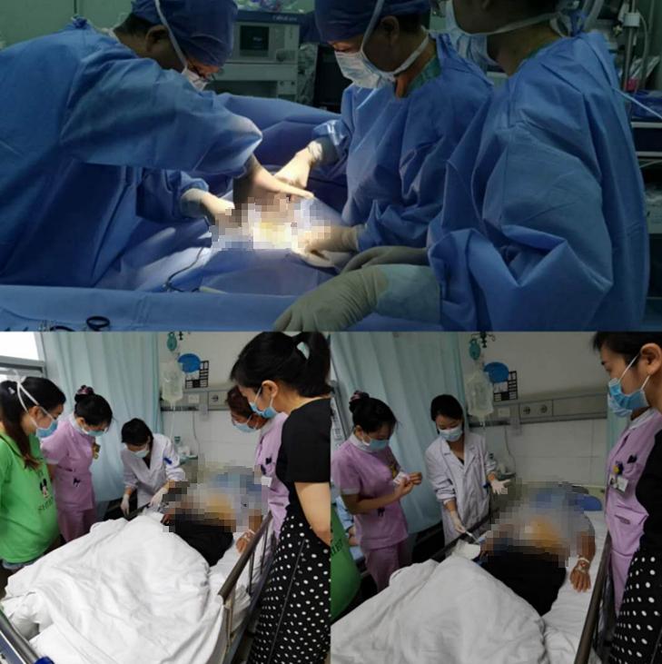 腹膜透析技术培训,腹膜透析是一种居家治疗方式