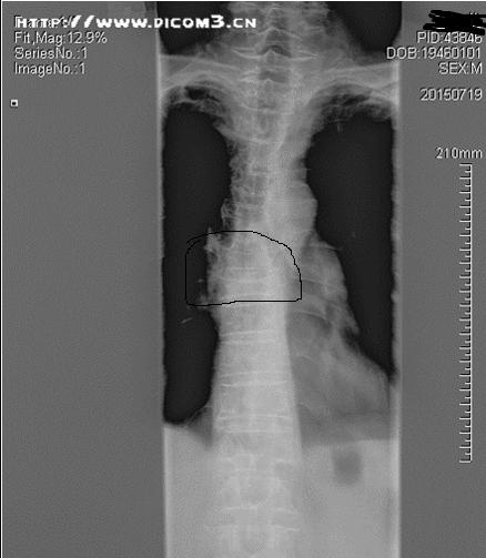 粑粑去哪儿,粑粑去哪了