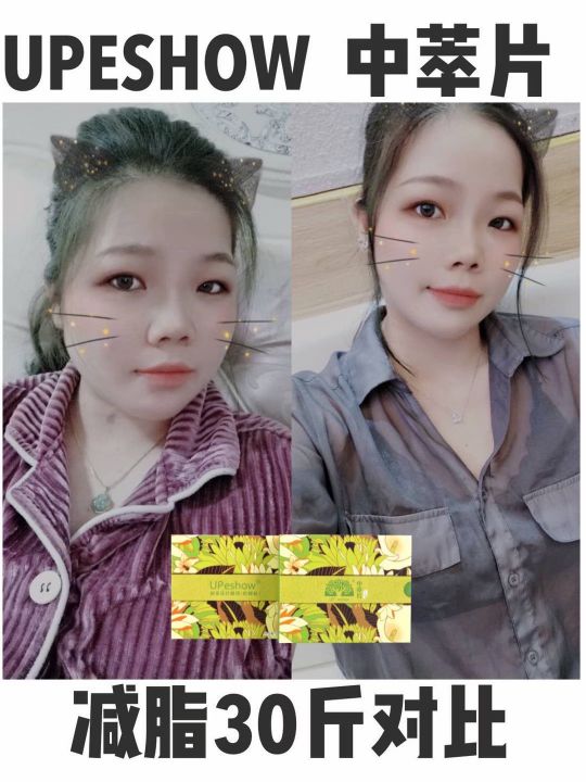 中萃片减肥副作用是什么最新,减肥黑科技是真的吗