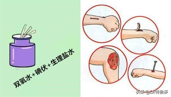 摔水泥地上擦伤会得破伤风吗,骑电车摔跤擦伤要打破伤风吗