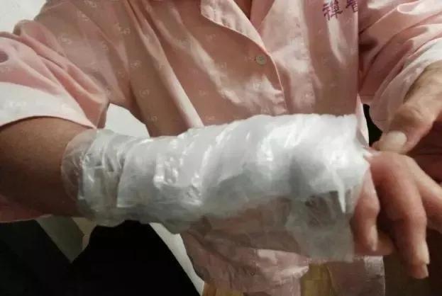 挤痘痘引发脑膜炎几率,挤痘痘会引发囊肿吗