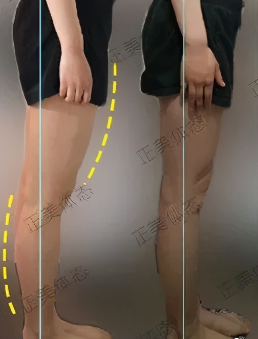 硬核腿部锻炼,硬核练腿的正确方法