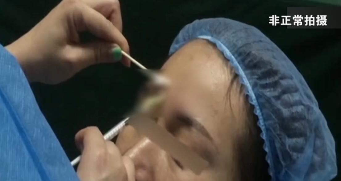 女子打假美容针被判刑,瘦脸针导致面颊塌陷