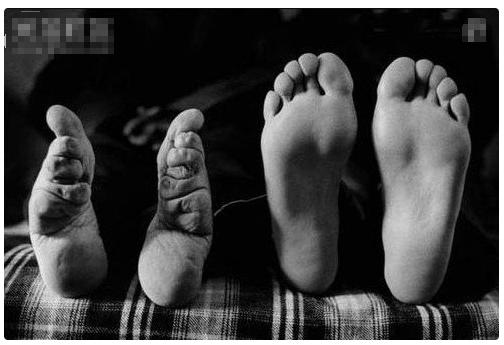 缠足的小知识,缠足是古时的陋习