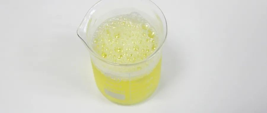 尿常规大部分人都做错了,想要准确的检测结果就要选择这样留尿