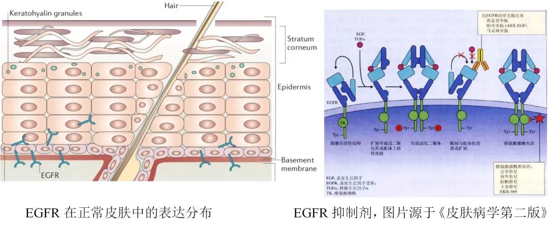 肺癌吃靶向药皮肤痒是怎么回事 (如何解决靶向药带来的皮肤瘙痒)