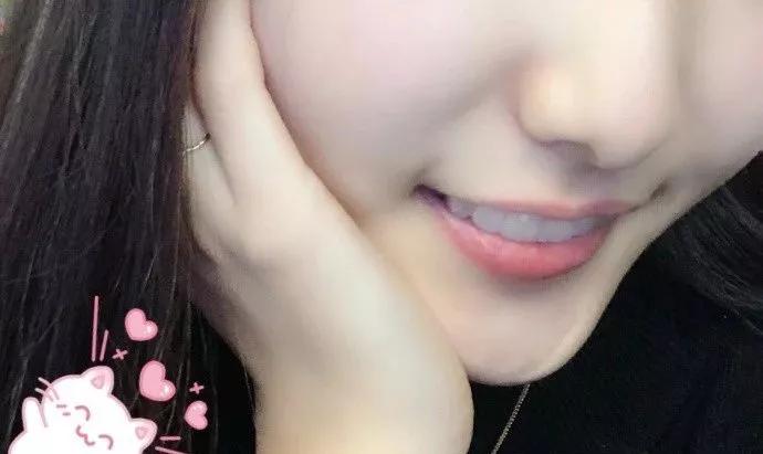 牙齿很整齐拔牙正畸前后效果,虎牙齿矫正的前几天有什么反应