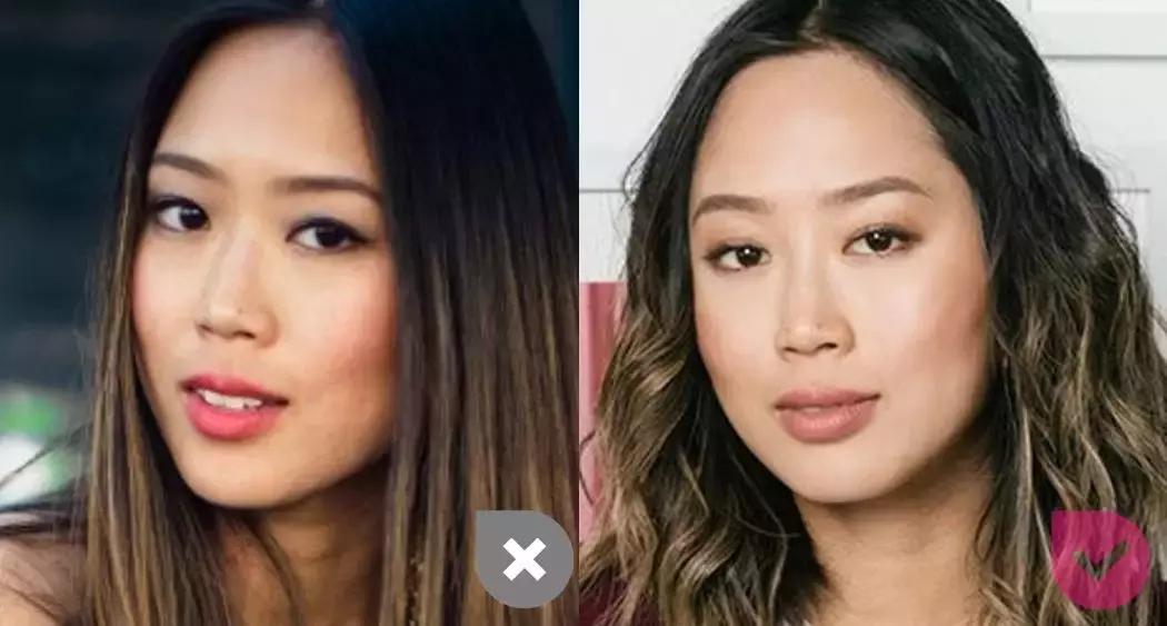 整牙都有哪些改变,整牙变美的一定要注意的6点