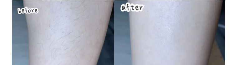 j-style脱毛仪怎么用,j-style脱毛仪怎样