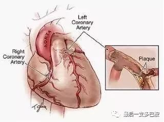 输液过敏，已经配了的药该退钱吗？
