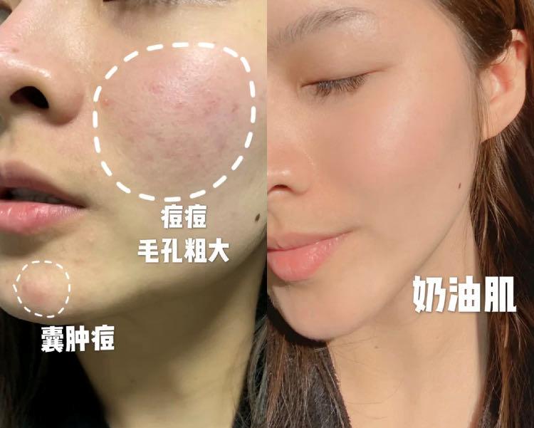 日本49岁贵妇为去皱，坚持用“开塞露”抗老长达20年，现今啥样？