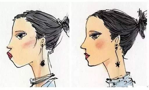 就两颗下排门牙不齐建议矫正吗,下牙不齐除了牙套还有什么方法