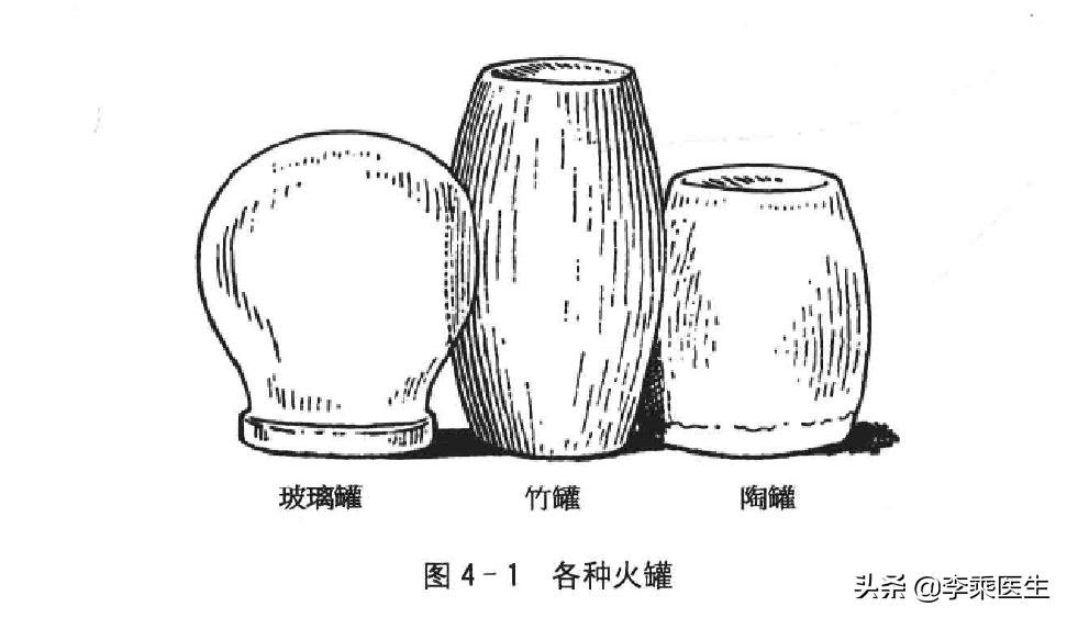 拔罐详细流程图解大全,拔罐法操作规范